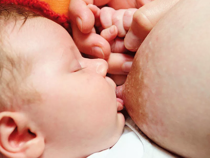 Tipos de mamilo e como influenciam a forma de dar mama Tipos de mamilo e amamentação